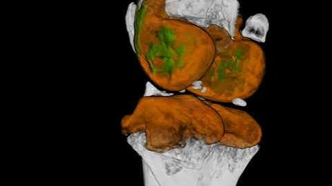 Micro-computed tomography (µCT) of knee joint