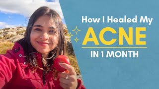 How I Healed My Acne in 1 Month