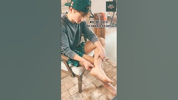 Achilles Tendon Self-Massage: Relieve Pain and Improve Mobility 💯🔥 #painrelief #foot #tendonitis