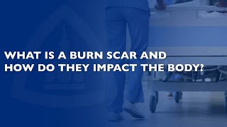 Burn Scar Treatment Q&A