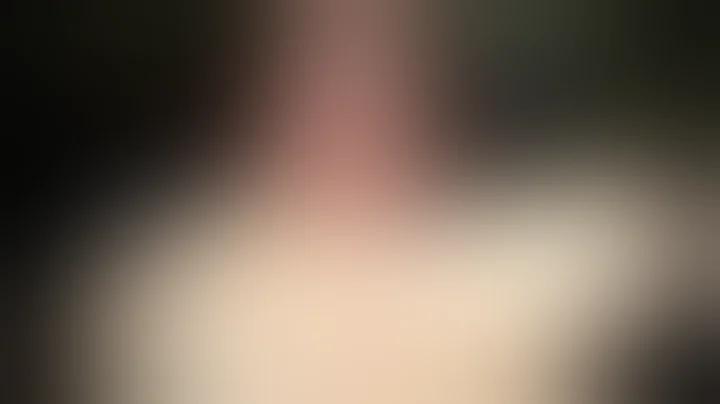 Beauty Blogger's Skin Picking Secret