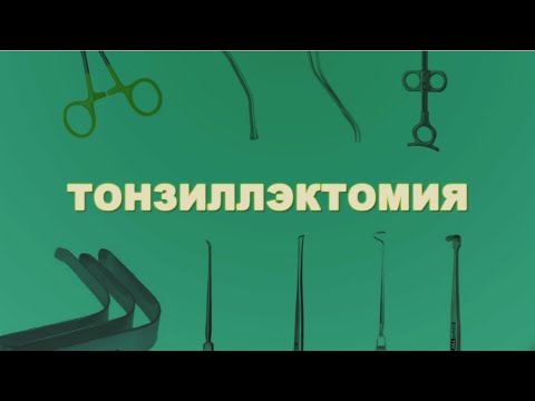 Тонзиллэктомия. Виды операции | Лечим правильно с Владимиром Зайцевым