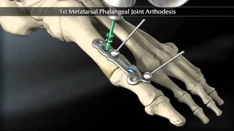 1stMTP 360 552WM "pa".mp4