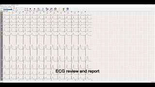 ECG Sync Quick Start Guide,CONTEC ECG Machine