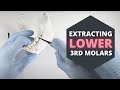 How To Extract Erupted Lower Third Molars | OnlineExodontia.com