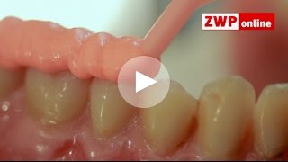 Dreve - StoneBite® Silikon für die Bissregistrierung