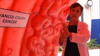 Understanding and Preventing Colon Cancer