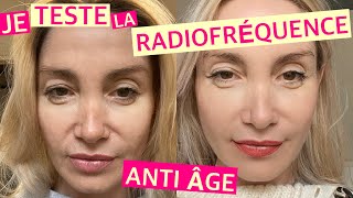 Je Teste La Radiofréquence Anti Âge