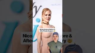 Nicole Kidman before and after plastic surgery #nicolekidman #plasticsurgeon #celebrity