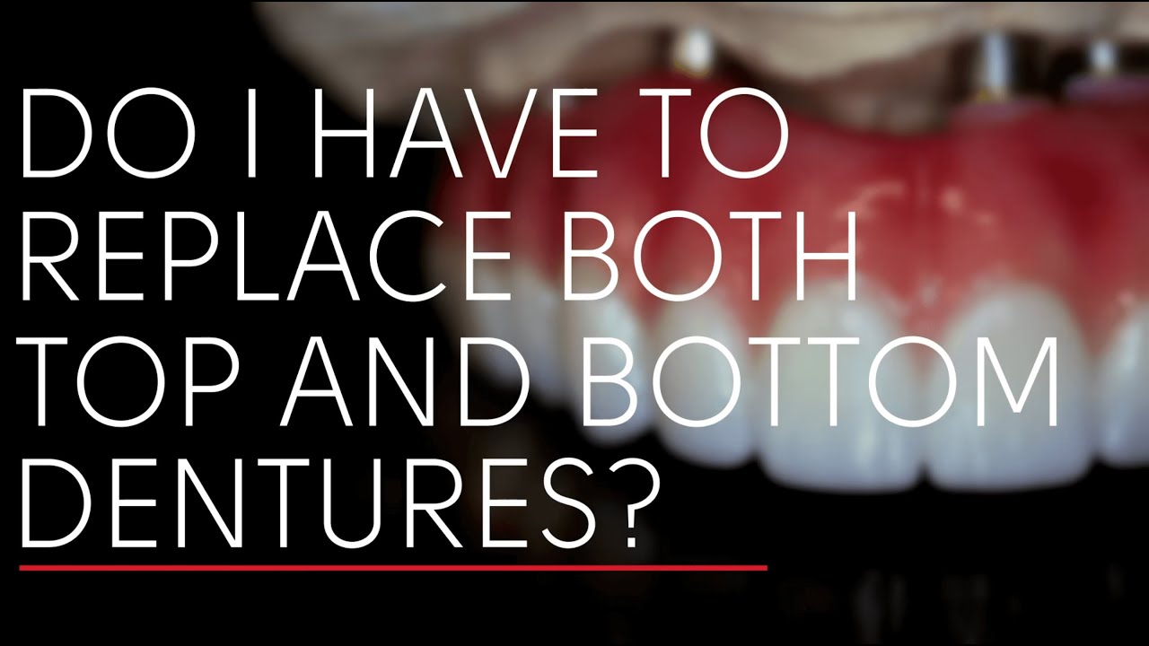 Do I Have to Replace Top and Bottom Dentures at the Same Time?
