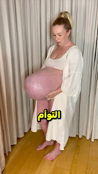 هذه الأم ضحت بحياتها من اجل حملها 🥺❤️ #shorts