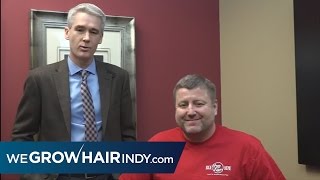 Hair Transplants: JMV from 1070 The Fan has a Multi-Unit Hair Grafting™ Procedure