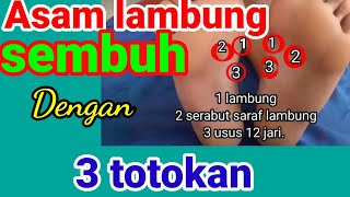 Pijat. Lambung kronis sembuh dengan di thrafi pijat Refleksi