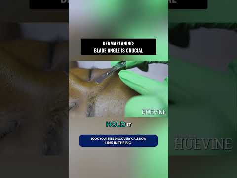 DERMAPLANING - BLADE ANGLE IS CRUCIAL