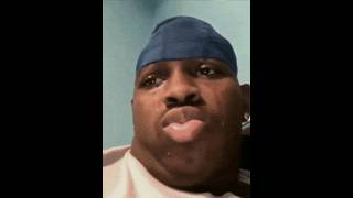 OMG I GOT BOTOX😱!! fun2 #shorts #youtubeshorts #trending#funny