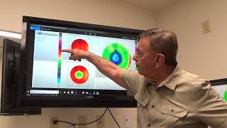 About Vision Shaping Treatment