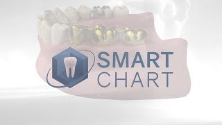 SmartChart™ - Overview and Detailed Demonstration