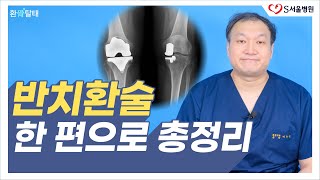 양반다리 가능한 “반만 하는” 무릎 인공관절수술 반치환술 총정리 ft. 장점 수명 부작용