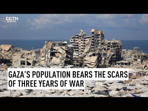 Three years of war leaves indelible scars on Gaza's population