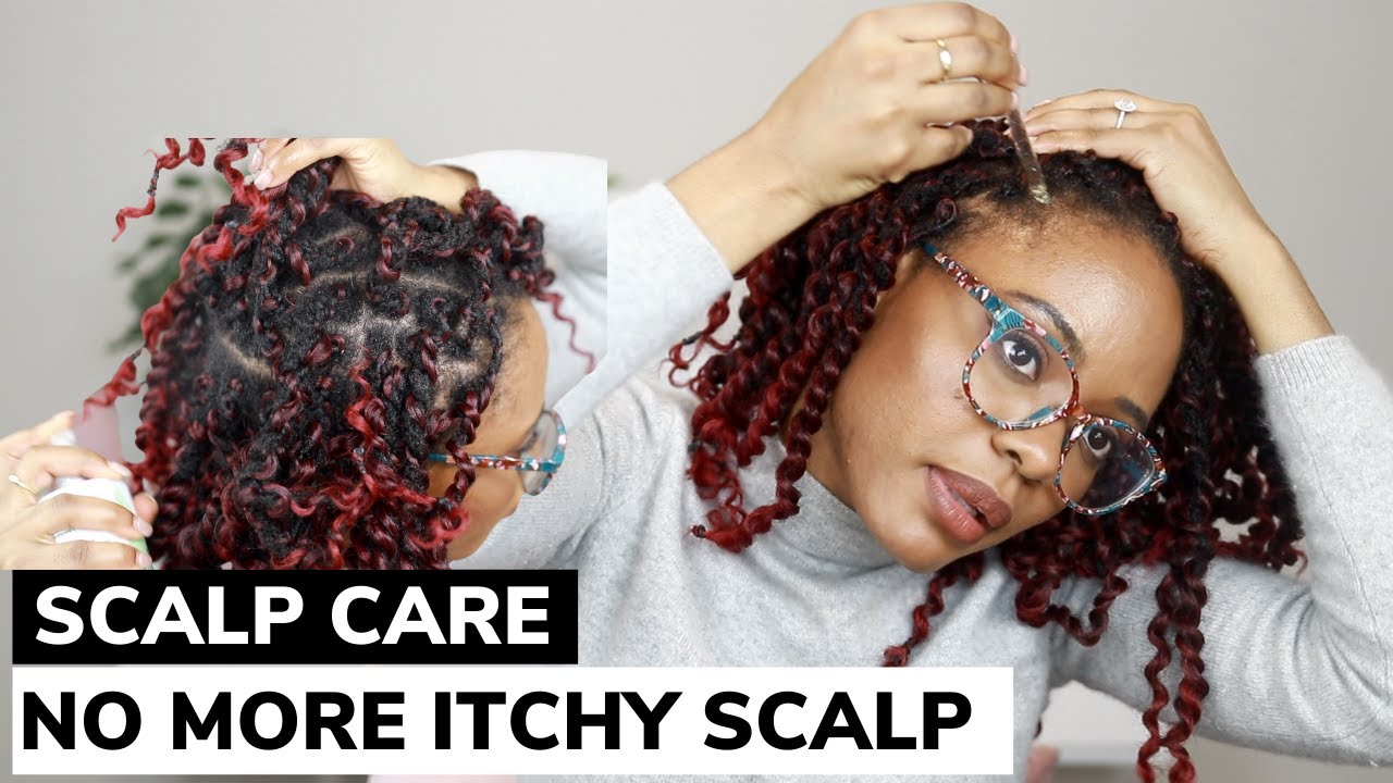 HOW TO CARE FOR YOUR SCALP WHEN YOUR HAIR IS BRAIDED (Protective Styling Tips)