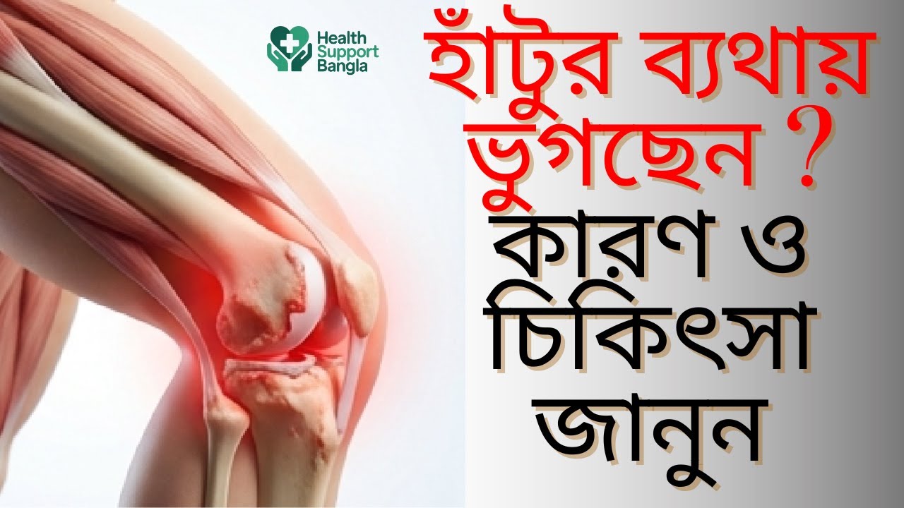 হাঁটু ব্যথার কারণ, আধুনিক চিকিৎসা ও স্বাভাবিক জীবনযাপন |Knee Pain Treatment.