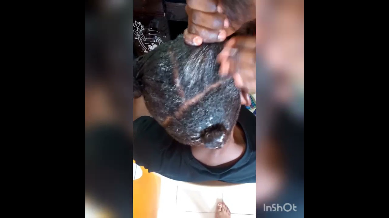 JINSI YA KUWEKA DAWA YA BOX(OLIVE OIL)