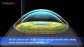 CATALYS™ Precision Laser System