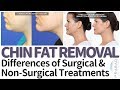 Double Chin Treatment - Pros and Cons of Surgical and Non-Surgical Solutions