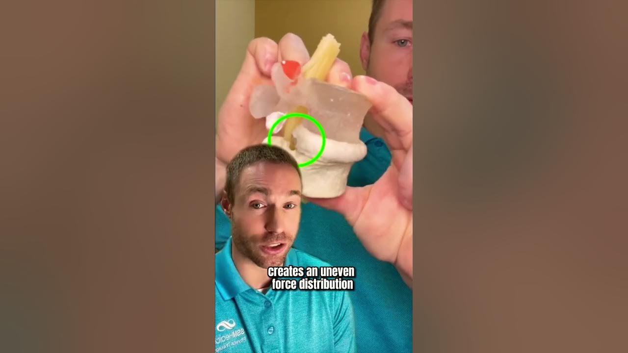 have-a-disc-bulge-youtube