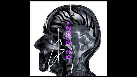 Amnesia - Nature over Nurture. (demo)