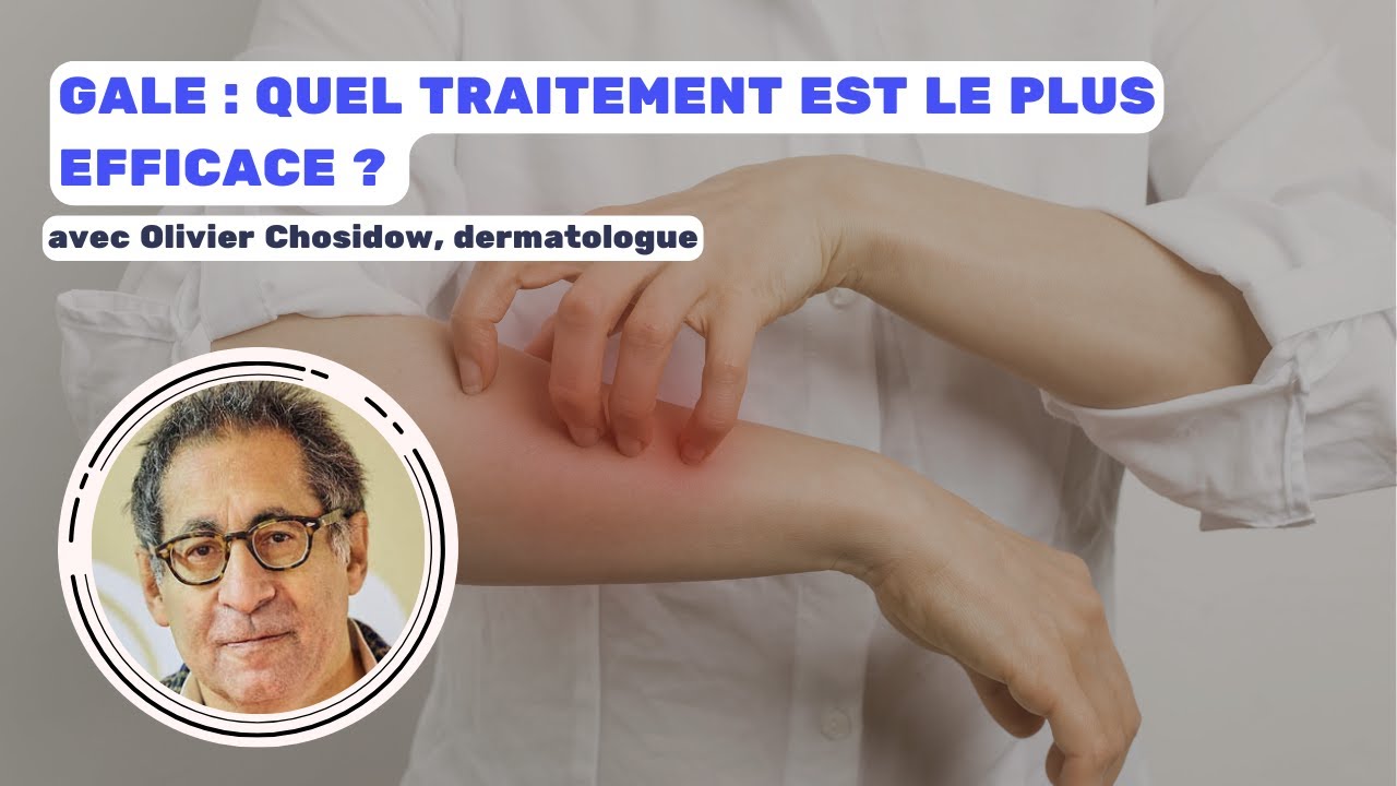 Gale : quel traitement est le plus efficace ?