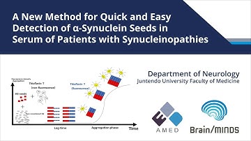 Quick and Easy Detection of α-synuclein Seeds in Serum of Patients with Synucleinopathies