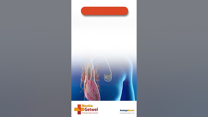 Pacemaker  Implantation | Neotia Getwel Multispecialty Hospital