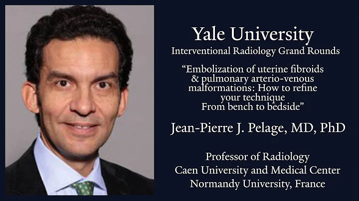 Embolization of uterine fibroids & pulmonary arterio-venous malformations