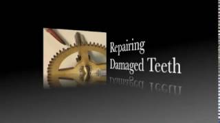 Clockclass - Damaged Teeth