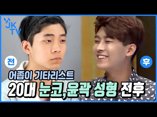 👦남자성형👦 눈, 윤곽, 지방이식을 한번에❔❕