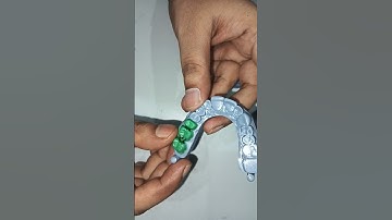 Offset coping design in exocad/ 3d printed patterns for metal casting