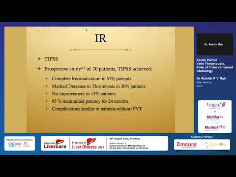 Part 2 - Acute Portal Vein Thrombosis.Role of Interventional Radiology - Dr Rohith P.V. Nair, Kochi