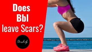Can I get rid of Cellulite with a BBL ? | Dr Jeneby BBL Procedure | Does BBL Leave scars? 2021
