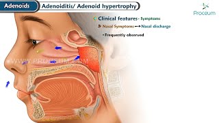 Pediatrics Animated Video Lectures (Trailer): Proceum Pvt Ltd
