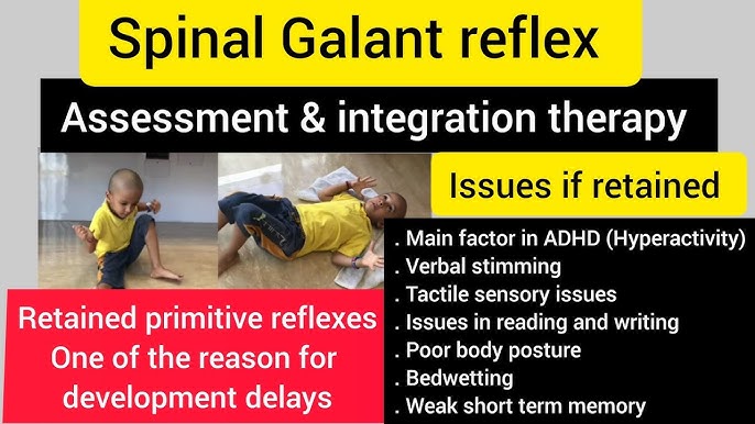 Understanding The Spinal Galant Reflex 2024
