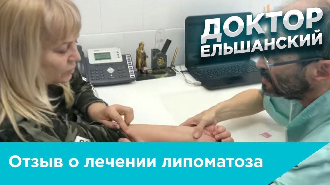 Отзыв о лечении липоматоза - YouTube
