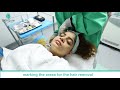 Facial Laser Hair Removal @SkinQure Clinic, Saket by Dr. Jangid |  Review by Prachi Kapoor