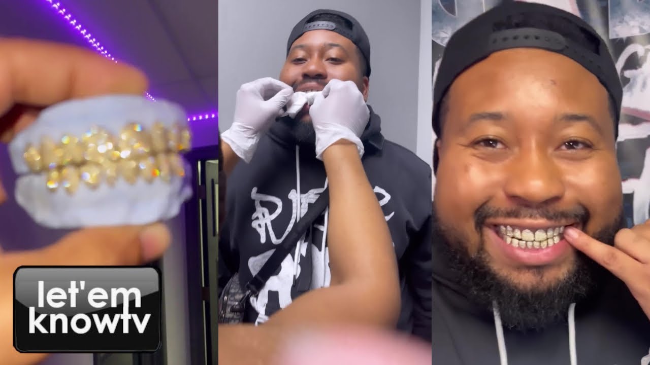 Dj Akademiks Cant Stop Smiling With His New Yellow Gold Grillz From