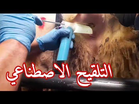 التلقيح الاصطناعي بالاسفنجة الاصطناعية