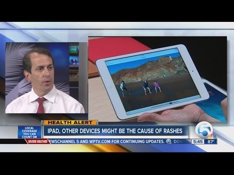 iPad, other devices might be the cause of rashes