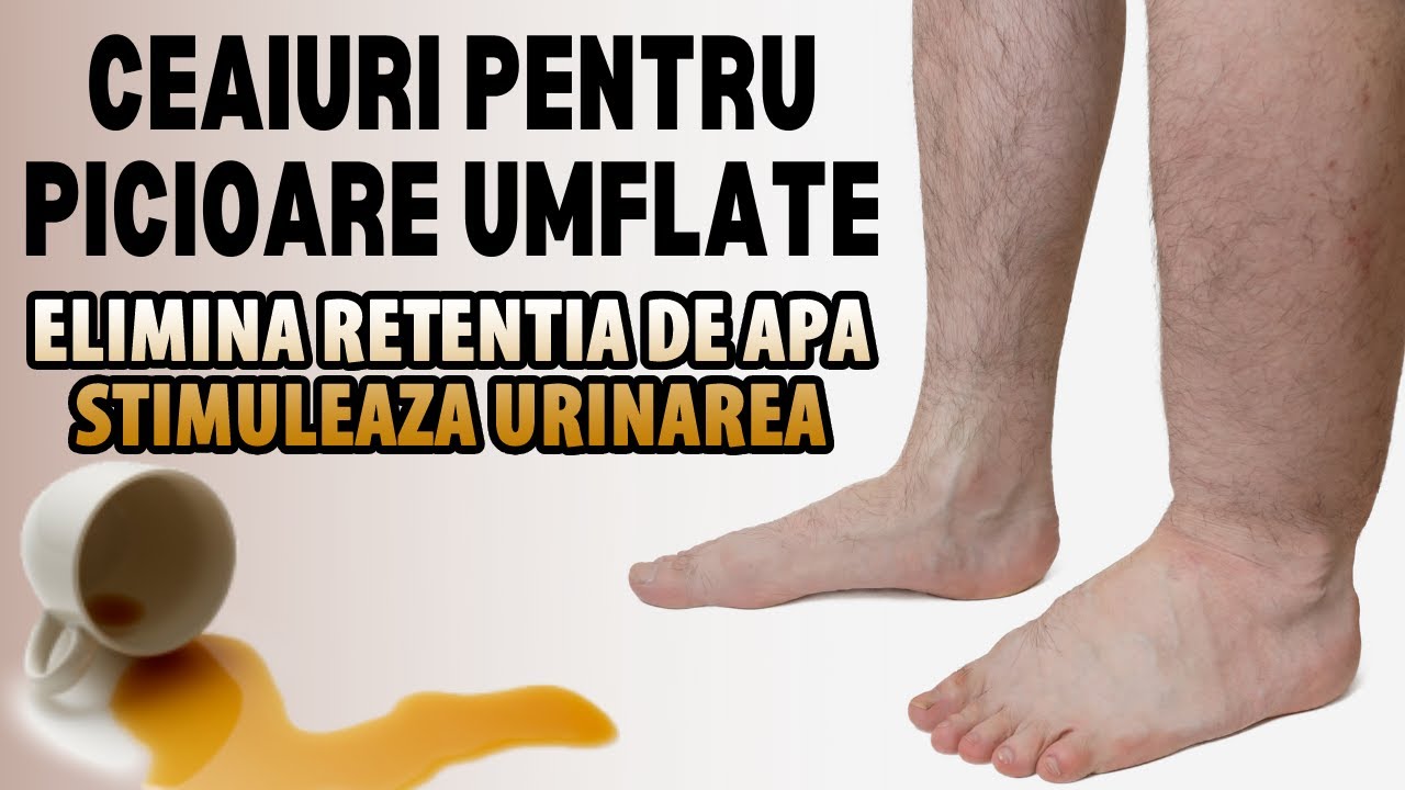 aliment detoxifiant ce medicament ajută la paraziți
