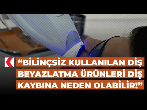Loading video