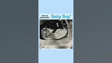 How To Predict Boy Baby In Scan Report Ramzi Theory Gender Prediction Baby And Mother Care 