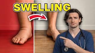 Seniors Poor Leg Circulation Drink This Daily to Support Blood Flow Doctor Tips 2026 Guide